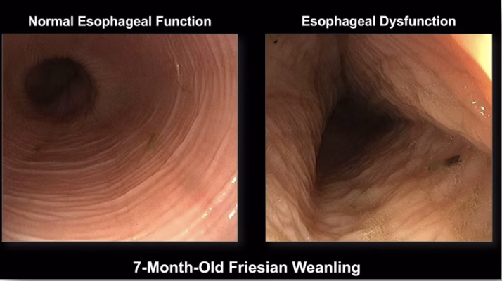 آندوسکوپی مری برای علایم اتساع مری